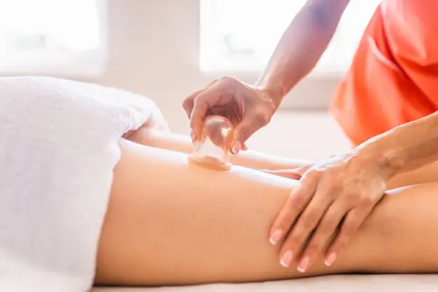 Masajista aplicando vacumterapia Masajista aplicando vacumterapia